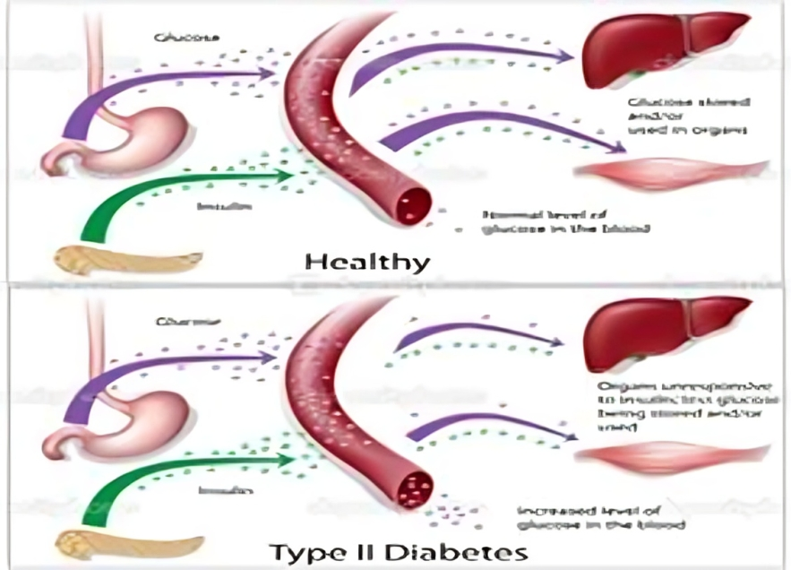 glucose regulation