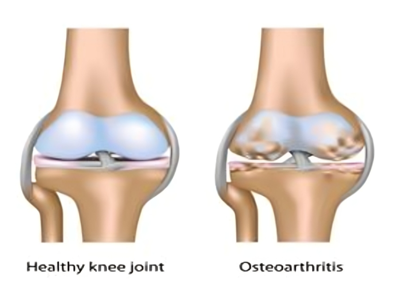 Joint and Bone Care